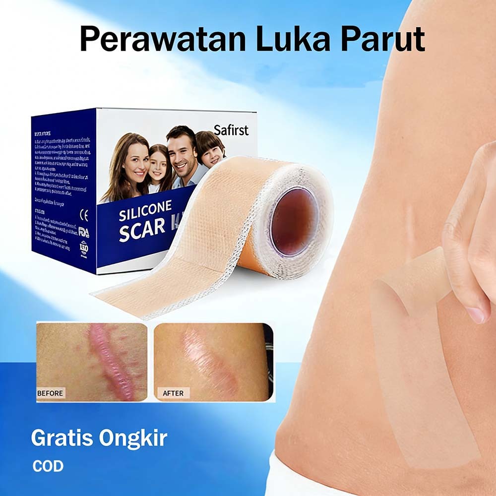 [COD]Safirst Silicone Scar Strip Patch|Silicone Scar Sheet Keloid Scar Patch 4cmx1m Plester Silikon 