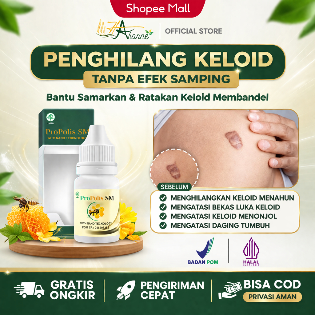 HAbonne - Obat Keloid Menonjol Tahunan, Bekas Luka Menonjol, Keloid Daging Tumbuh, Keloid Di Dada, P