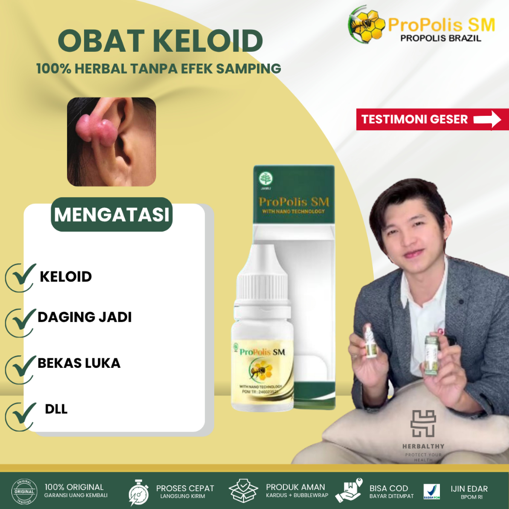 obat bekas luka, obat keloid, Obat herbal penghilang keloid, Obat keloid menahun, PENGHILANG BEKAS L
