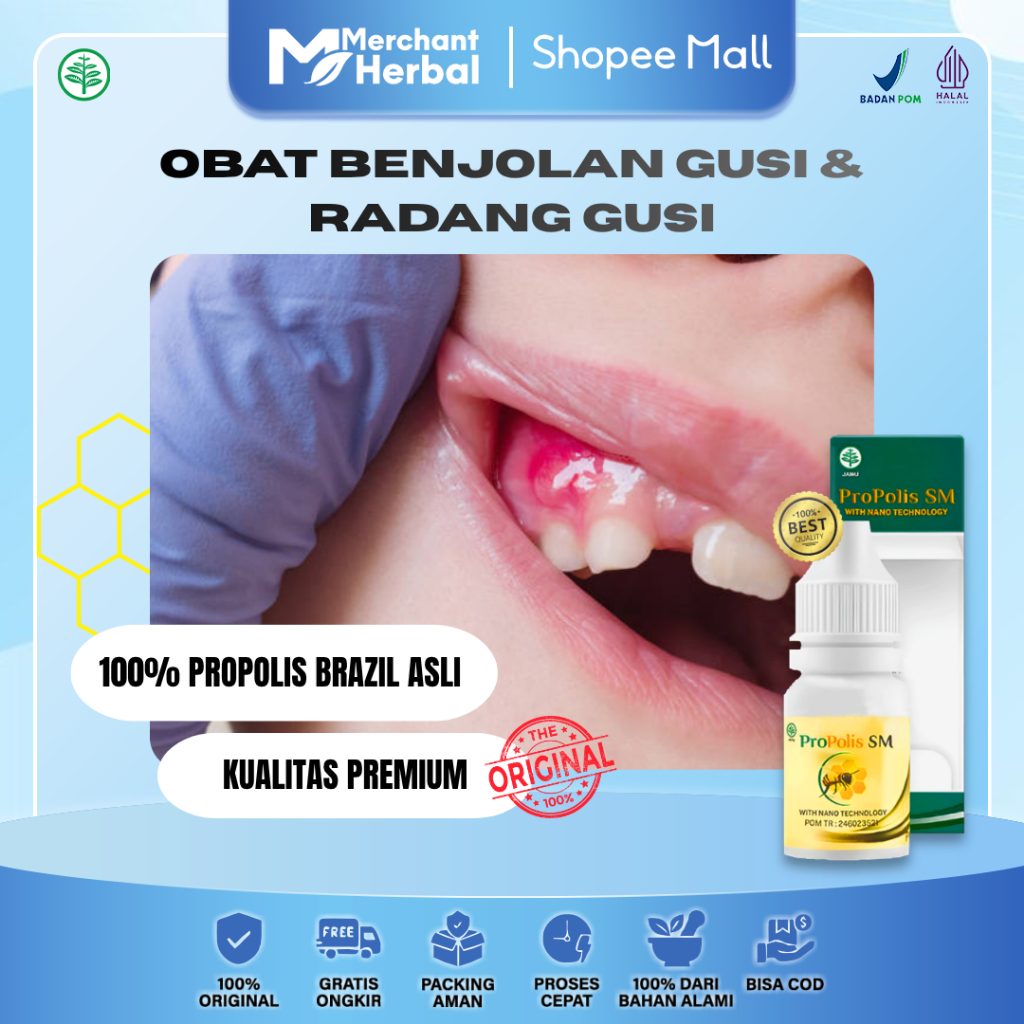 Benjolan Gusi & Radang Gusi Bernanah – Propolis SM