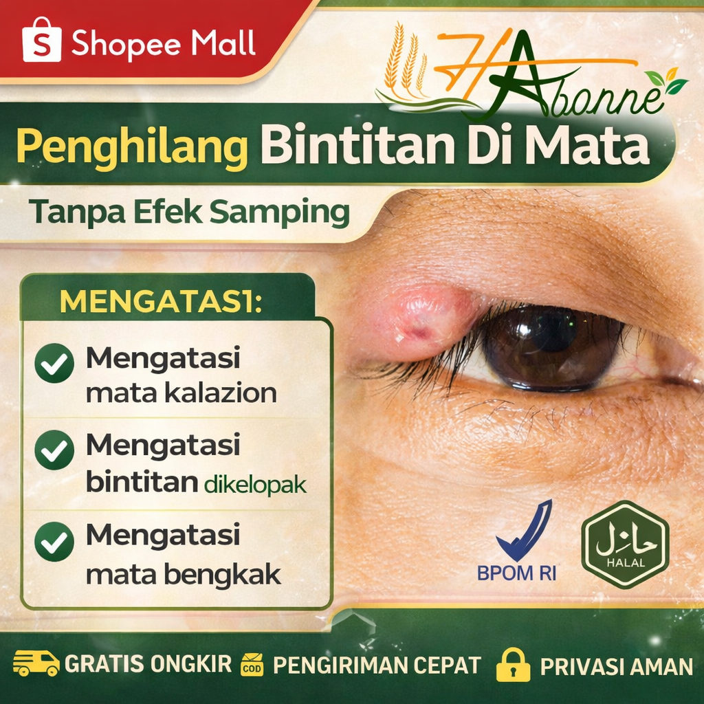 Obat Mata Kalazion Penghilang Benjolan Di Kelopak Mata Benjolan Di Kantung Mata Bintitan Bengkak Kut