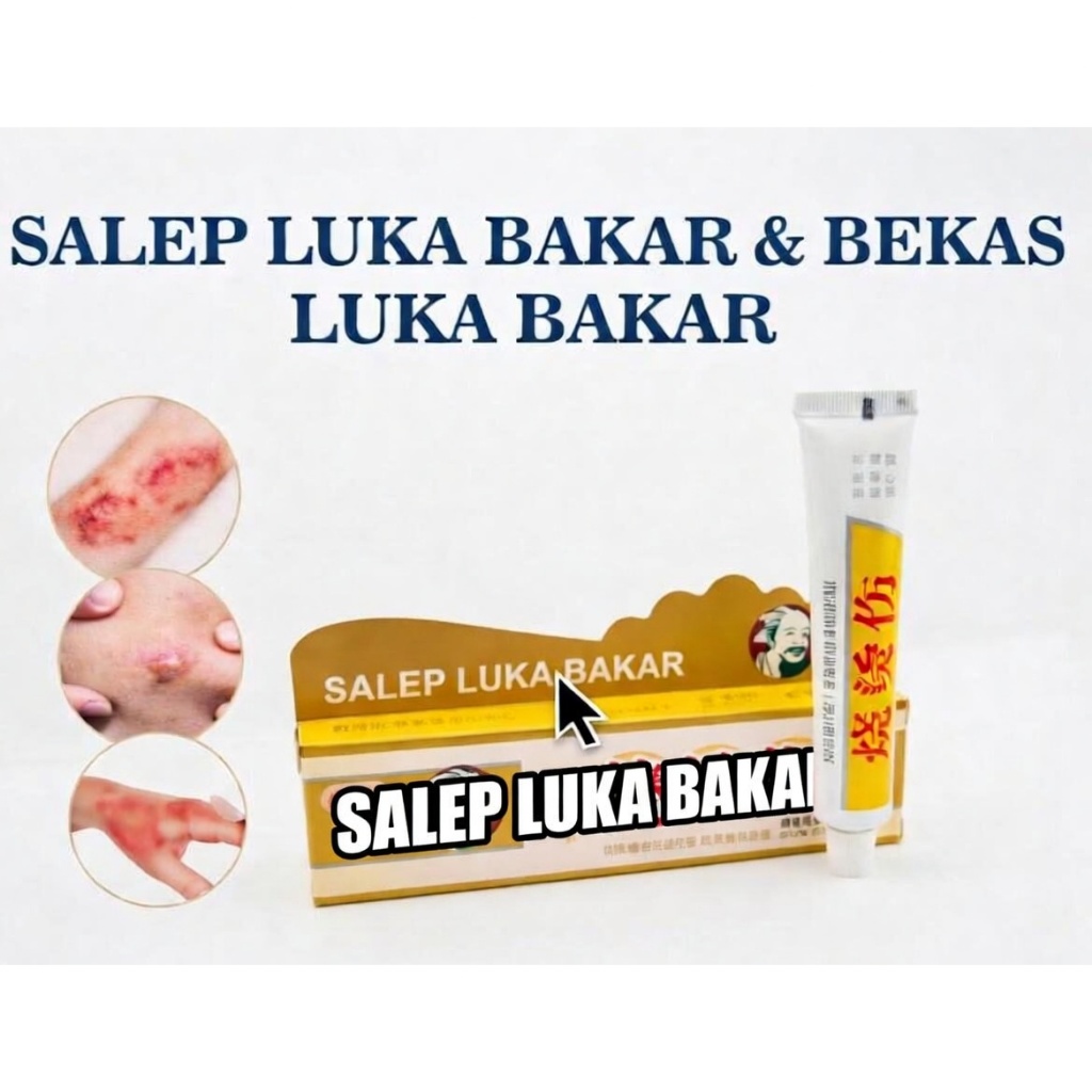 Obat Salep Cream Herbal Cina Luka Bakar Ampuh Cepat Original COD