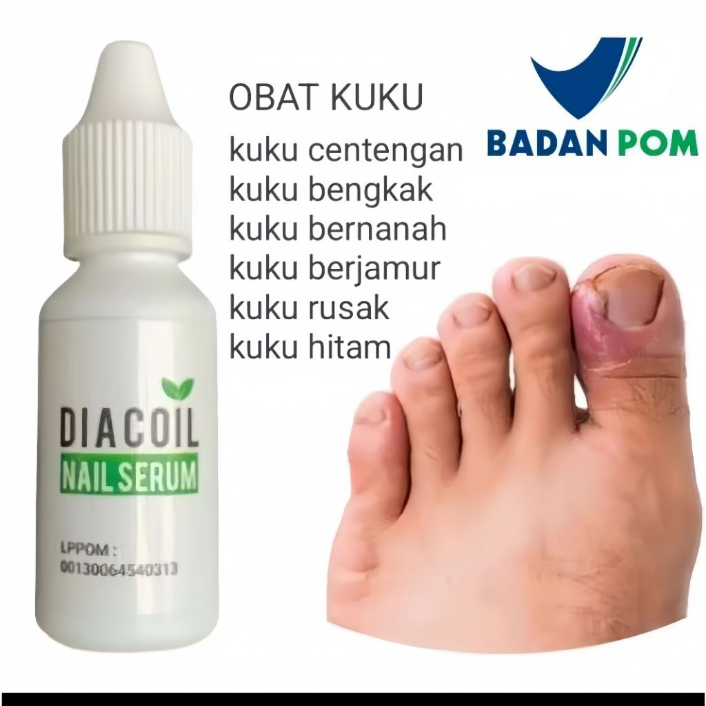 Diacoil Nail Serum 15ml Original Penghilang Kuku Cantengan Rusak Bernanah Patah Kutikula Nail Art Pe