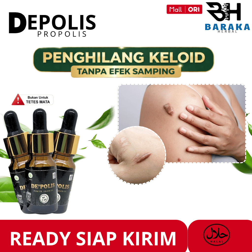 Obat Obat Keloid Daging Tumbuh, Keloid Menonjol Tahunan, Bekas Luka Menonjol, Keloid Daging Tumbuh, 