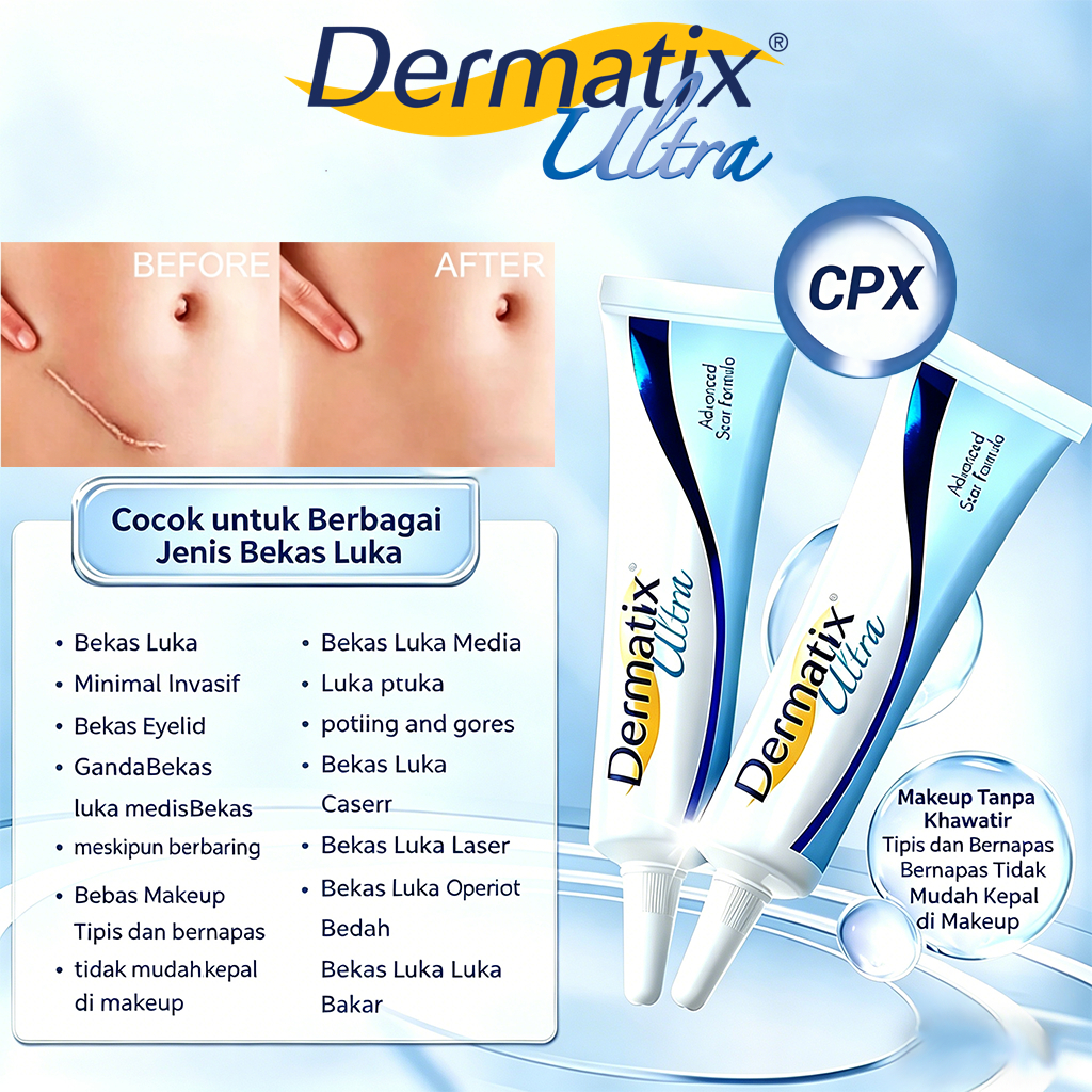 Dermatix Ultra Gel 15gr Penghilang Bekas Luka Jerawat Luka Operasi Luka Bakar Stretch Mark Asli Orig