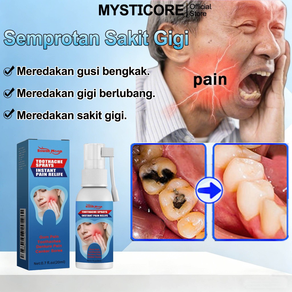 MYSTICORE Obat sakit gigi Semprotan sakit gigi Obat Sakit Gigi Berlubang Spray Penghilang Nyeri Gusi