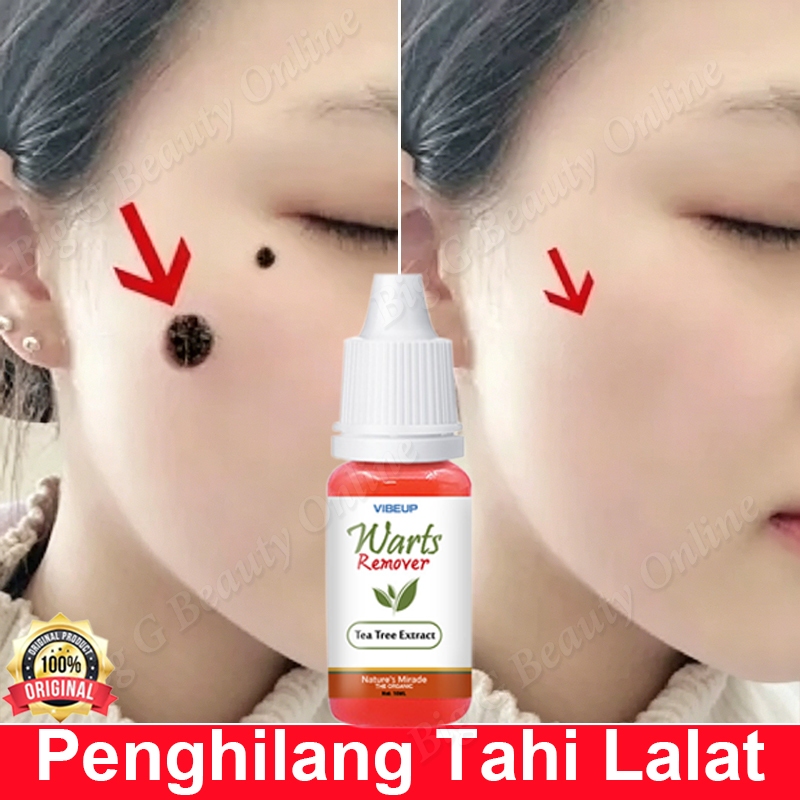 Penghilang Tahi Lalat Di Wajah Serum Obat Penghilang Tahi Lalat Penghilang Kutil Dan Tahi Lalat Peng
