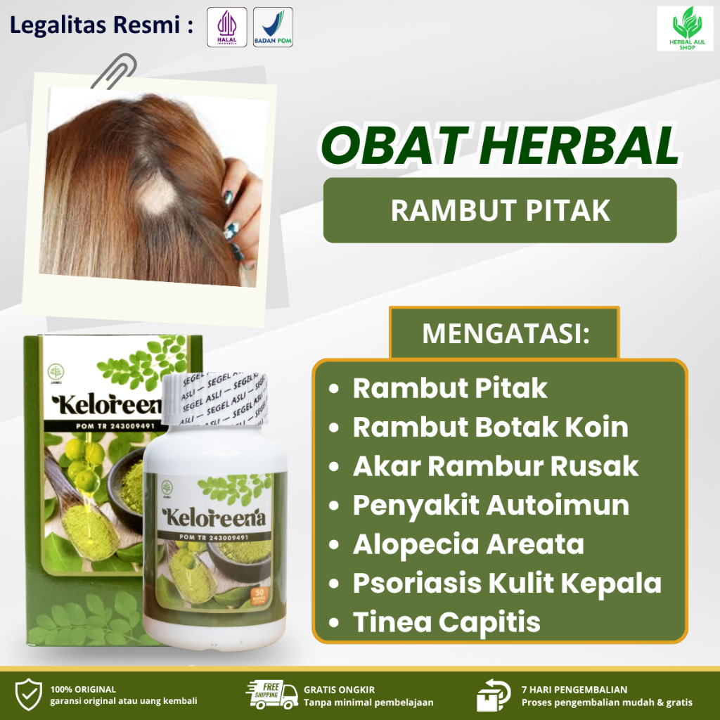 Kapsul Keloreena Vitamin Khusus Untuk Rambut Pitak, Rambut Botak Koin, Akar Rambur Rusak, Rambut Ron