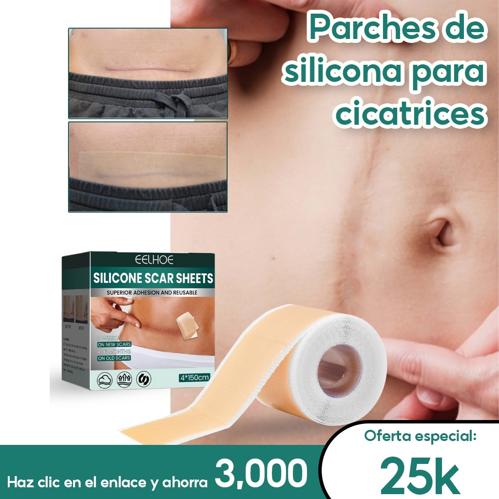 EELHOE Silicone Scar Sheets 1roll Silicone Keloid Penghilang Bekas Luka Keloid Plester Silikon Pengh