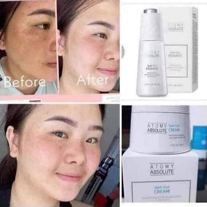 Atomy absolute 2in1 spot out essence+cream  wajah flek dan bintik ori