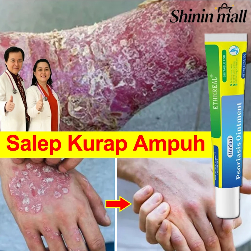 Salep Kurap Ampuh Cepat Hilang Salep Psoriasis Salep Eksim Kering Dan Gatal Obat Panu Kurap Onat Gat