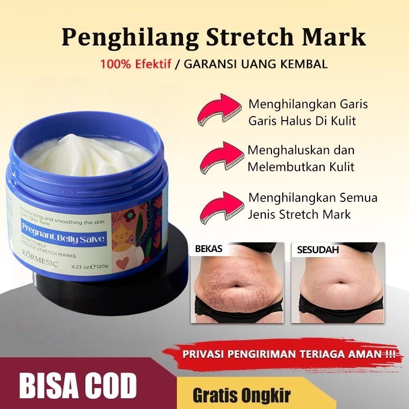 Krim Stretch Mark Herbal, efektif menghilang stretch mark, garis-garis lemak, penghilang stretch mar