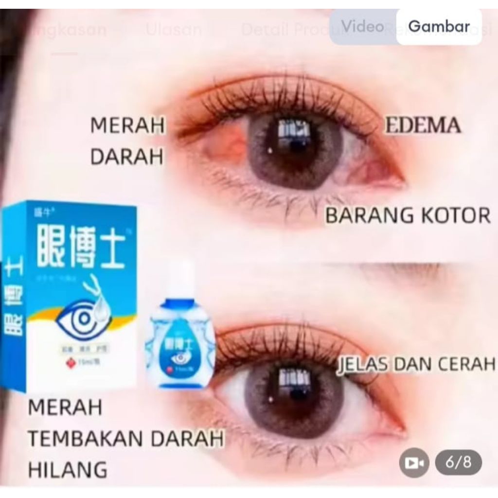 EYE DROPS OBAT TETES MATA NO 1 JEPANG / TETES MATA JEPANG OBAT TETES MATA BERLEMAK KEKUNINGAN PTERIG