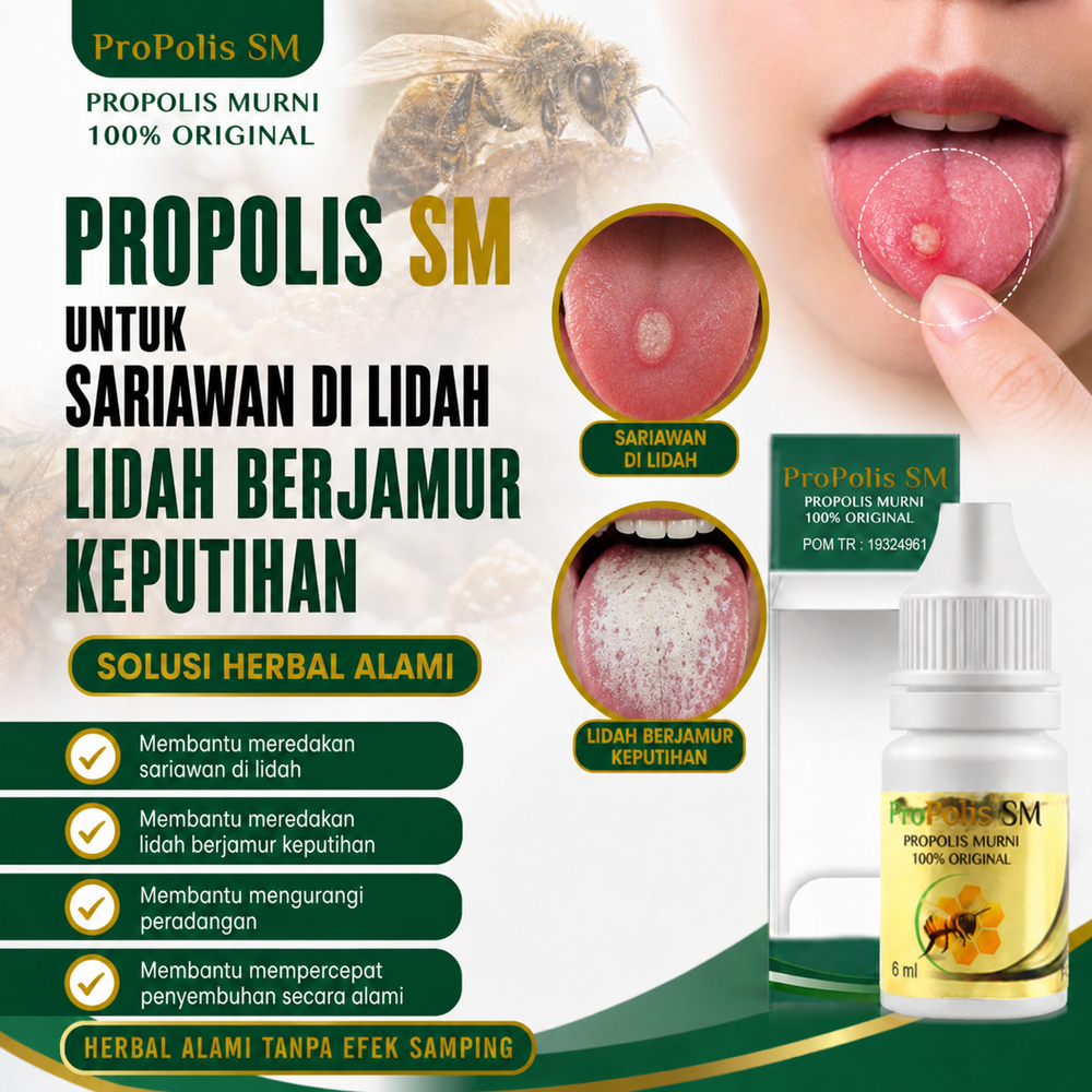 Obat Sariawan Lidah , Sariawan Lidah Luka , Sariawan Anak Dan Dewasa , ProPolis SM 100% ASLI