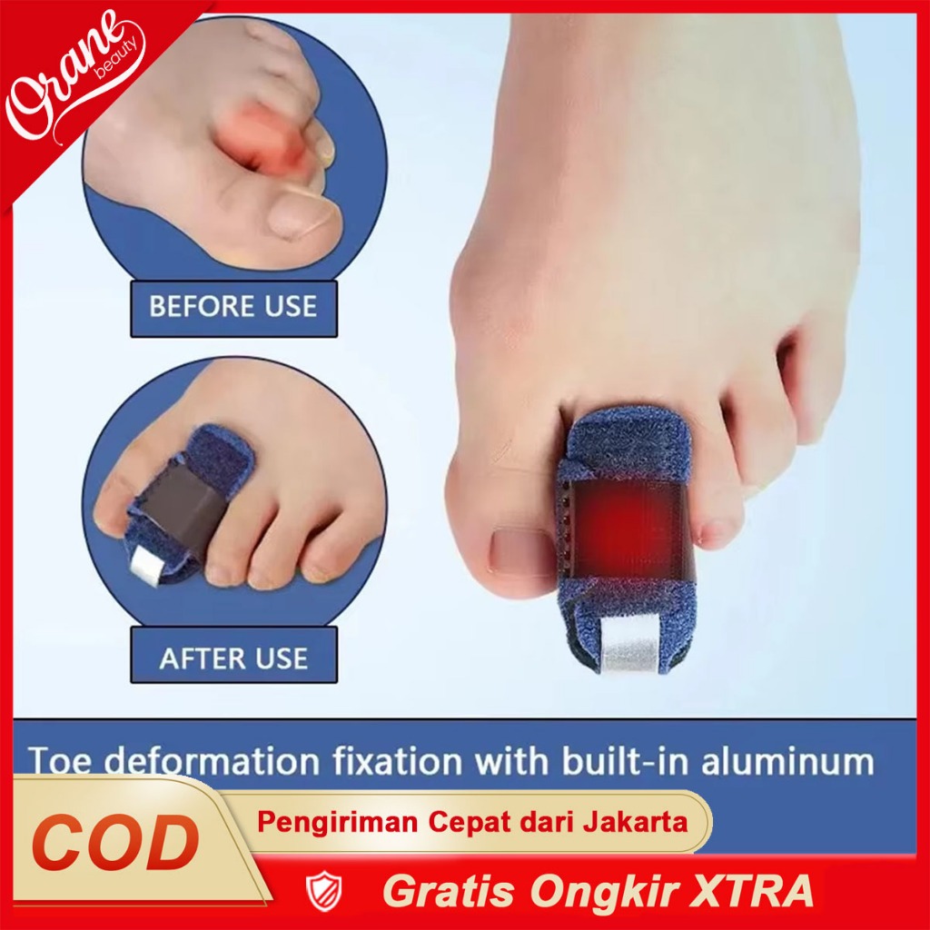 Oranebeauty Alat Pelurus Jari Kaki Penyangga Pelurus Jari Kaki Patah Terkilir ​Bengkok Bunion Correc