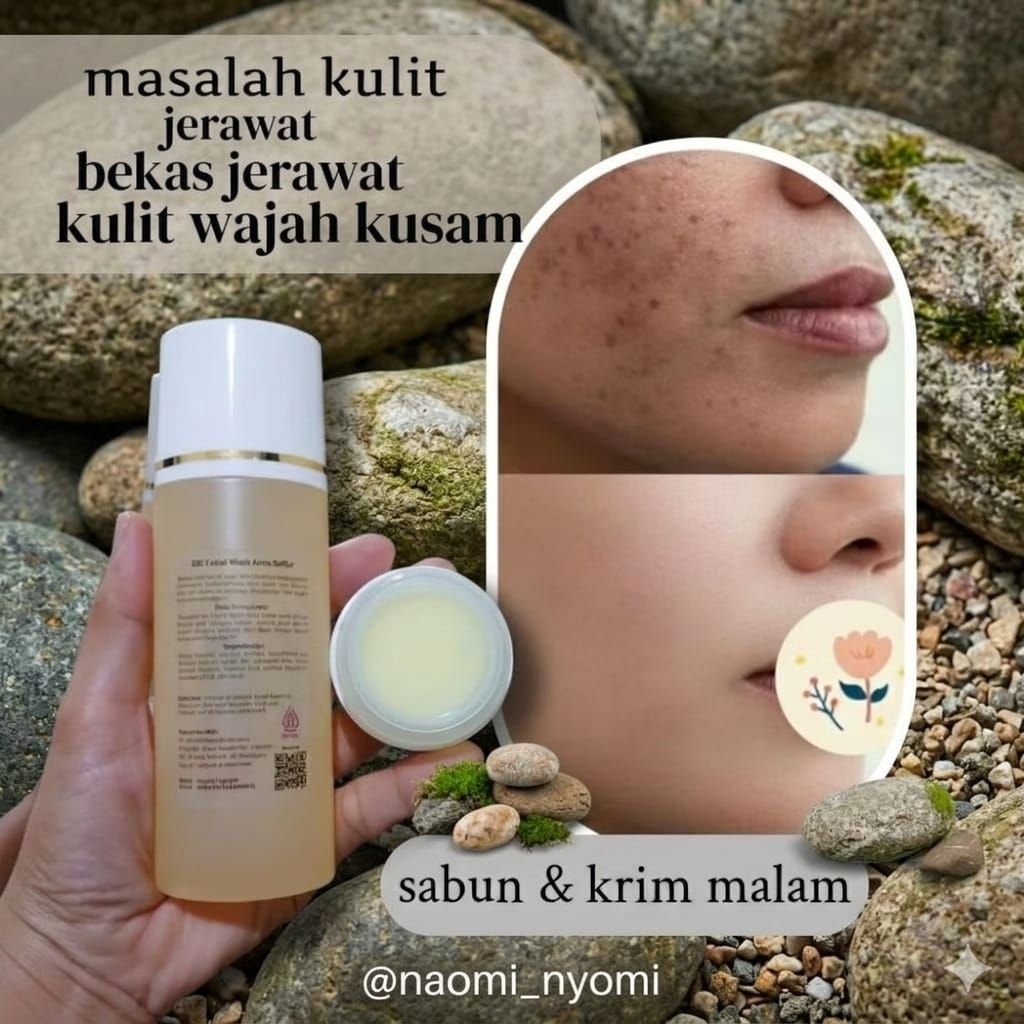 PAKETAN JERAWAT FLEK HITAM MEMBANDEL