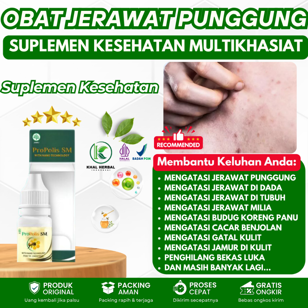 Obat Jerawat di punggung, Bintik di Punggung, Penghilang Jerawat di Punggung, Penghilang jerawat Pun