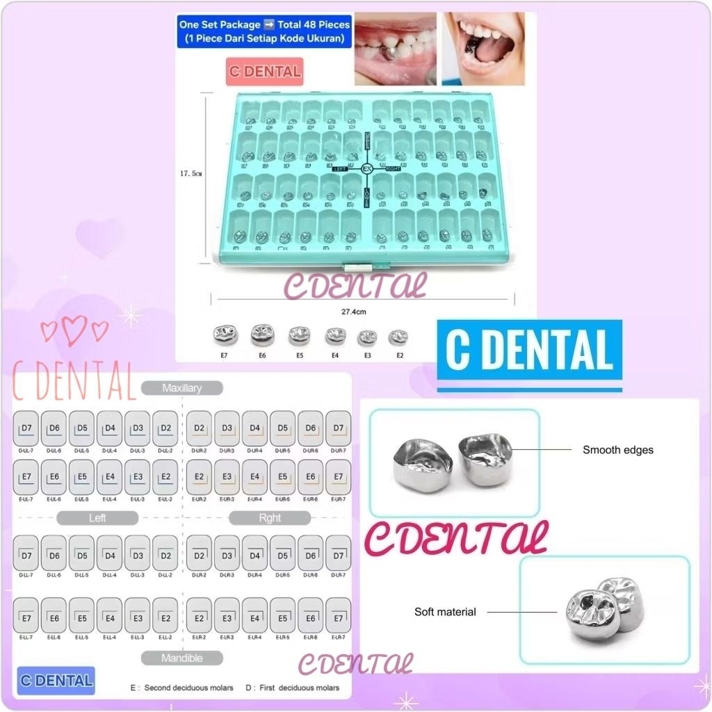 [48 Pcs] Dental Pedo Deciduous Molar Metal Crown SSC Gigi Desidui Anak First Second Molar Upper Lowe