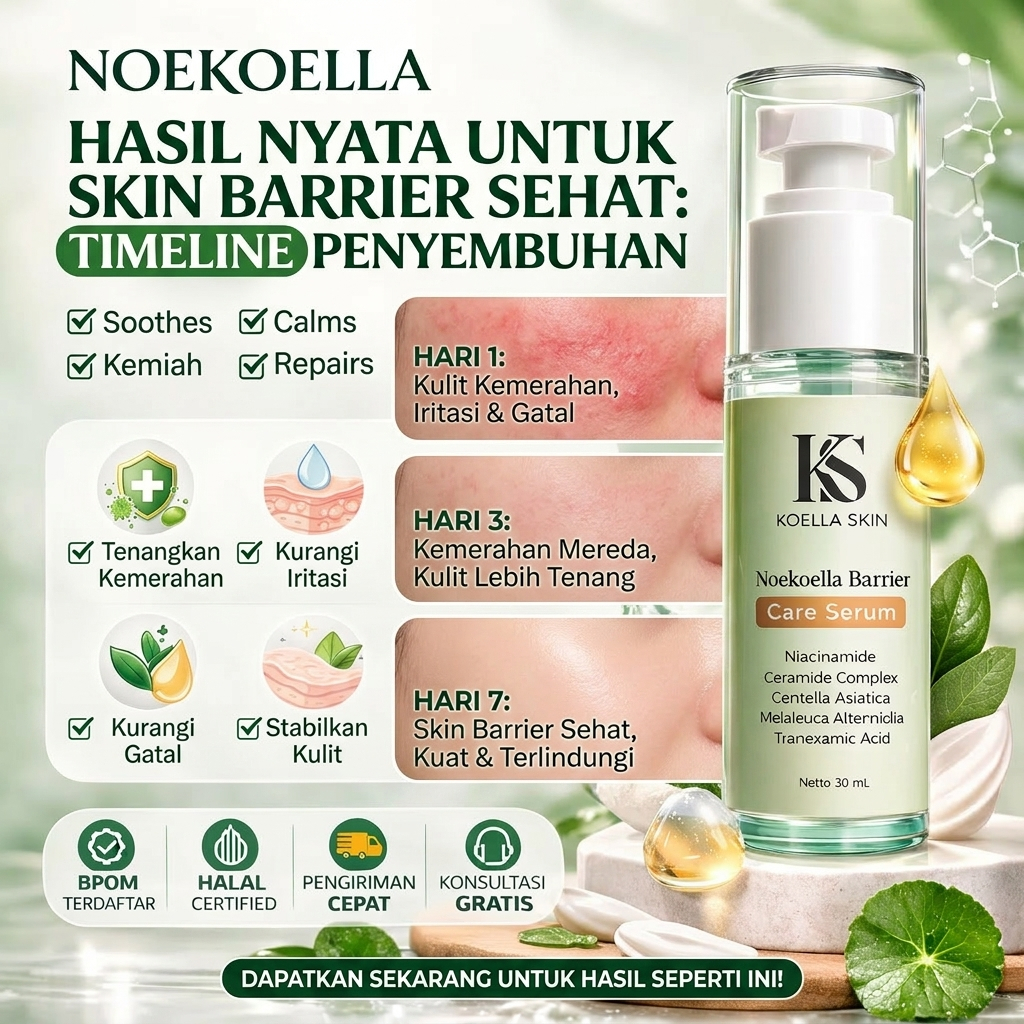 Noekoella Krim Salep Herbal Alami Perawatan Kulit Sensitif Gatal Eksim Kadas Kudis Jamur Kurap Selan