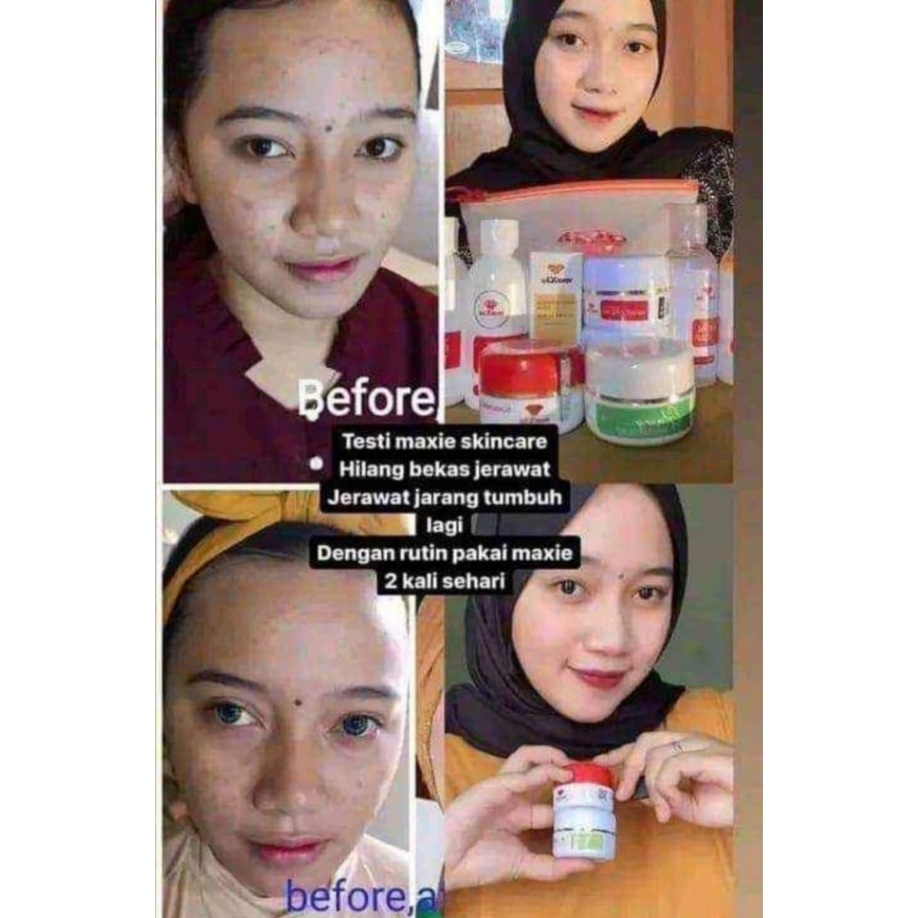 [COD] Cream Maxie Btl BPOM [Wajah Putih dan Glowing] Embos EXPYR 2025 EMBOS POTNYA Cream Pemutih waj