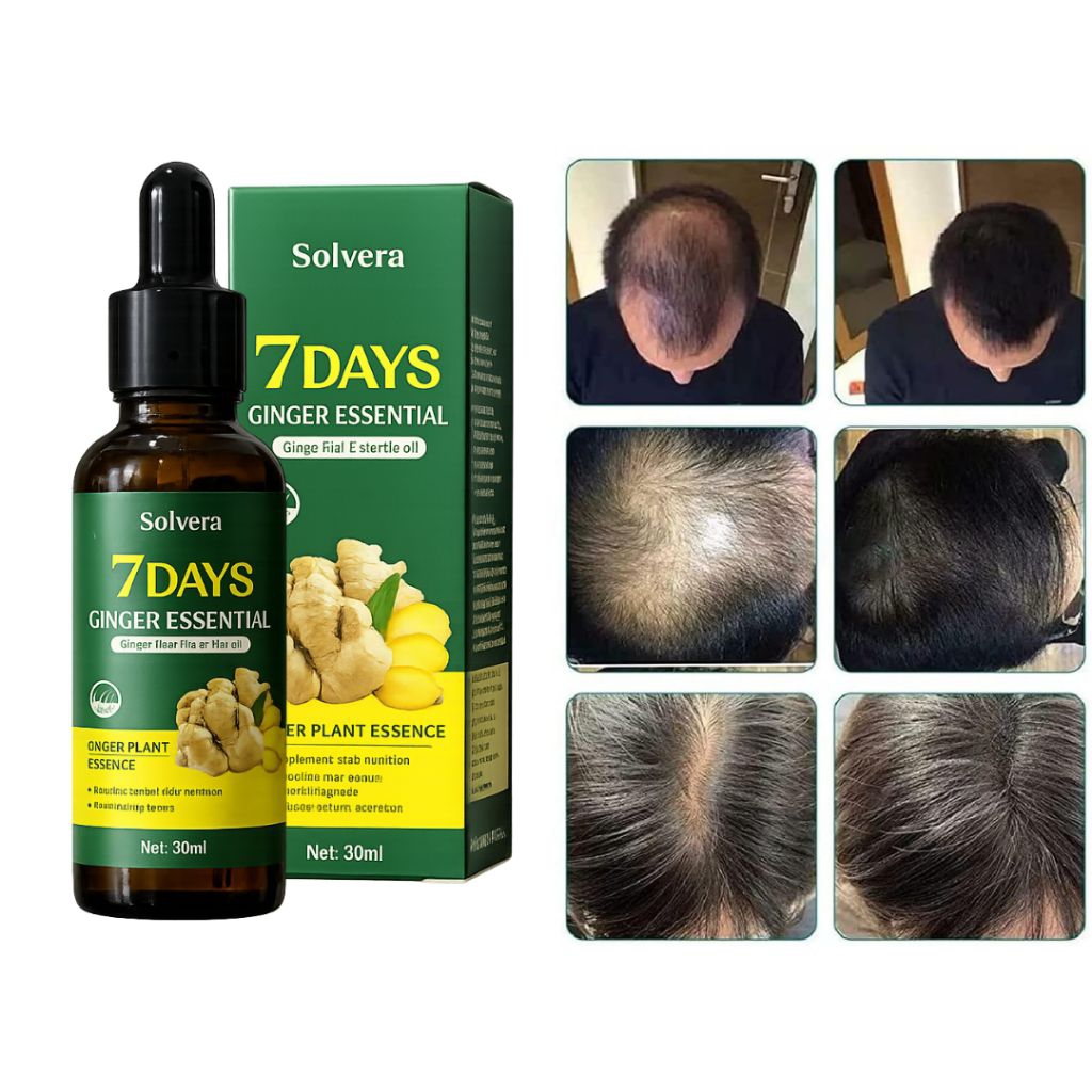 Serum 7 Days Ginger Hair Essential Oil