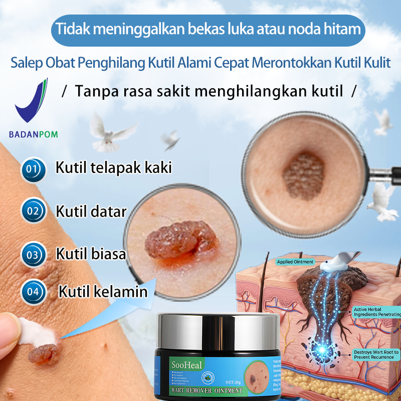 salep kutil,Obat Penghilang Kutil,20g,Ampuh menghilangkan kutil secara permanen,Hilangkan Kutil Tunt