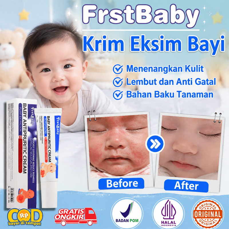 Salep eksim kering paling ampuh Salep biang keringat untuk bayi Salep gatal eksim tidak lengket 15g 