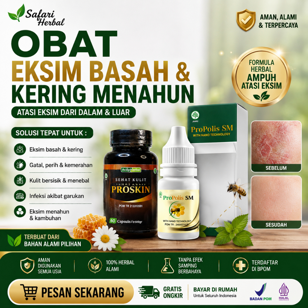 Obat Gatal Eksim Basah dan kering Menahun Bernanah