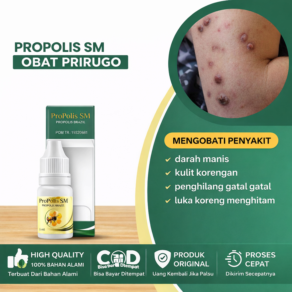 Propolis SM untuk Prurigo Nodularis – Obat Gatal & Bintik Hitam