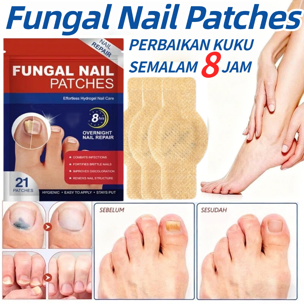 Obat Jamur Kuku Obat Cantengan Kuku Rusak Perawatan Kuku Berjamur Nail Repair Fungal Nail Treatment 