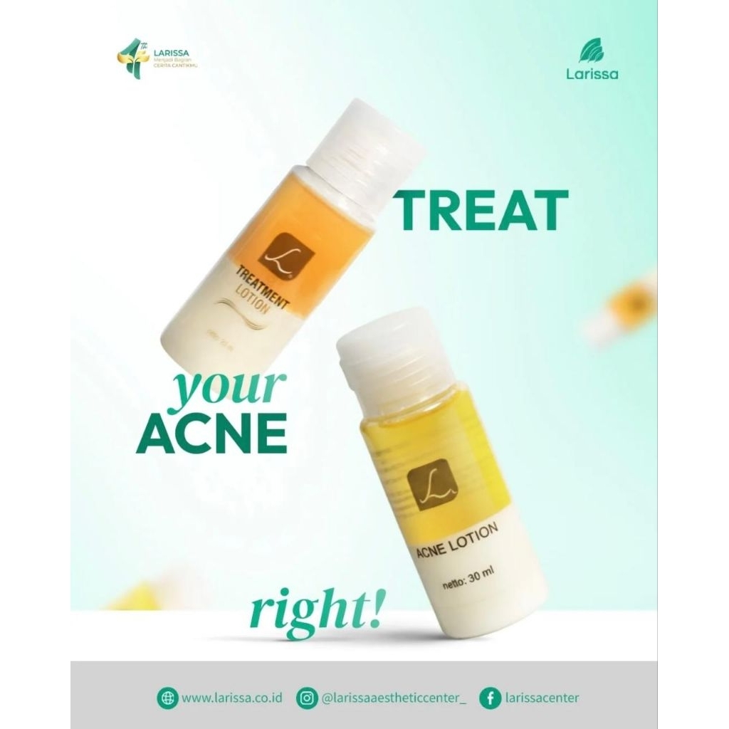 Acne lotion Larissa / totol jerawat Larissa /obat jerawat larissa