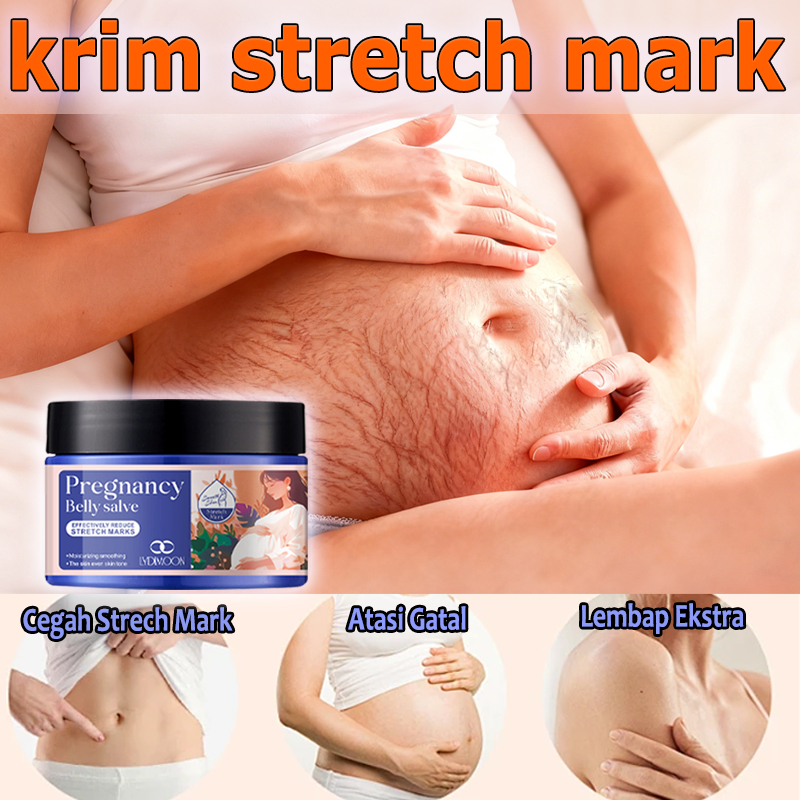 Krim Stretch Mark Herbal Aman Ibu Hamil - Anti Gatal, Mengurangi Strech Mark & Tingkatkan Elastisita