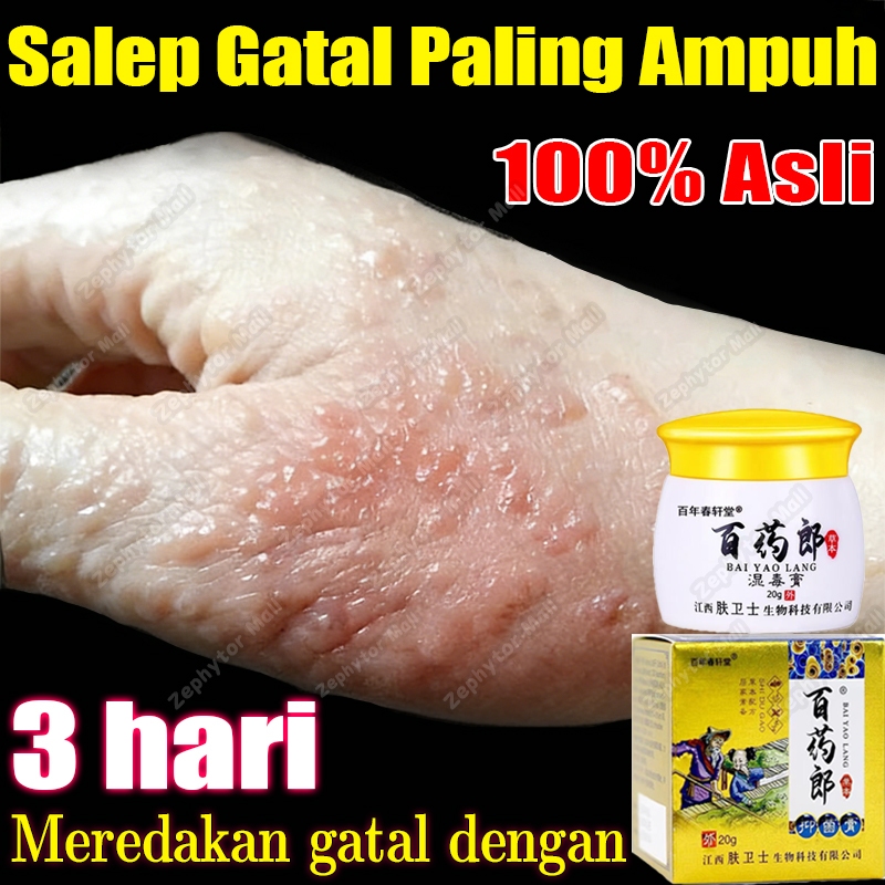 salep china gatal paling ampuh salep eksim kering dan gatal obat gatal selangkangan salep bayi untuk
