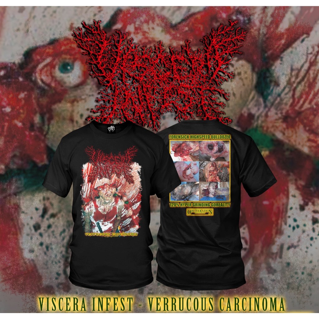ORIGINAL TSHIRT VISCERA INFEST - Verrucous Carcinoma