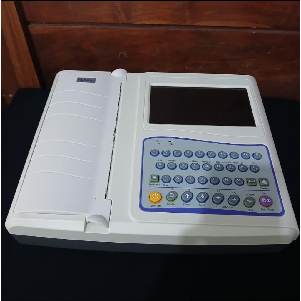 EKG 12 Channel Second Normal