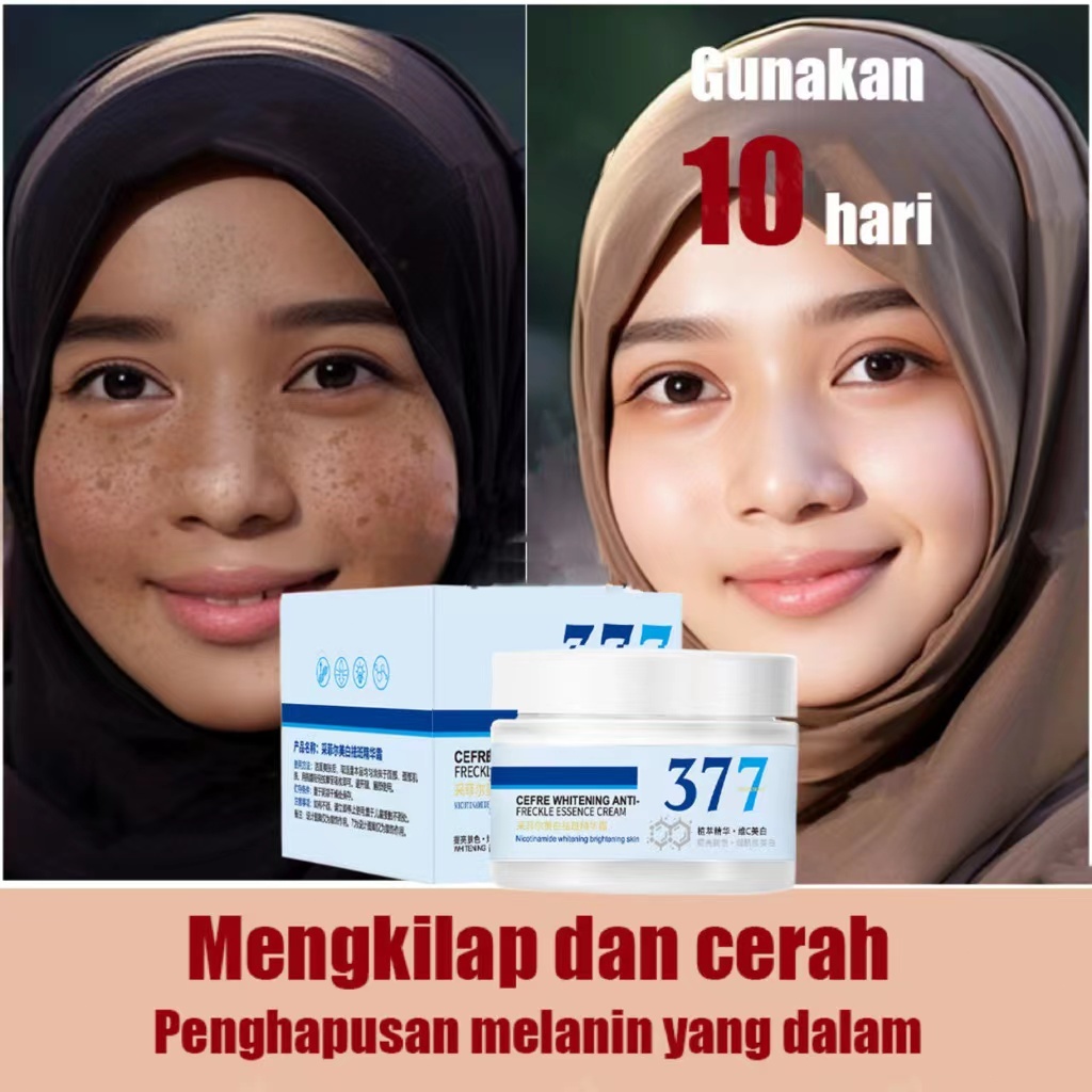 krim Serum cream Flek Hitam Cream Penghilang Cream flek Penghilang 50g Pemutih Asli Dan Penghilang B