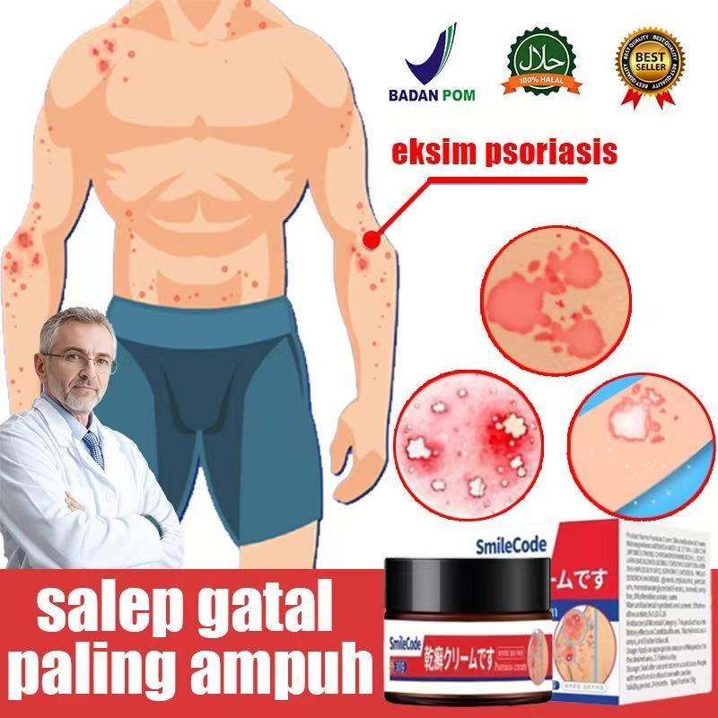 Salep gatal selangkangan Salep eksim Salep Eksim Kering dan Gatal Salep Gatal China Paling Ampuh Oba