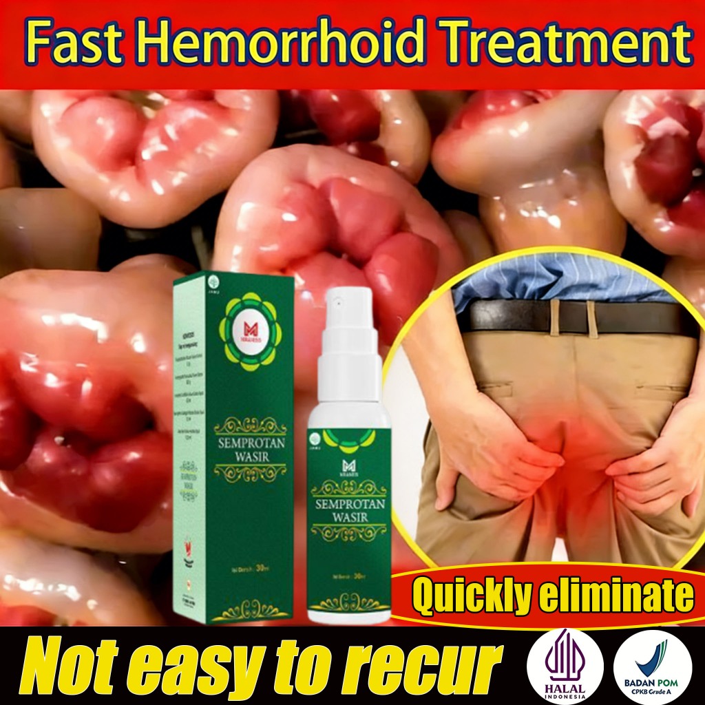 Obat wasir semprot salep ambeien paling ampuh salep wasir obatambeienpalingbagus cina 30ml salep was