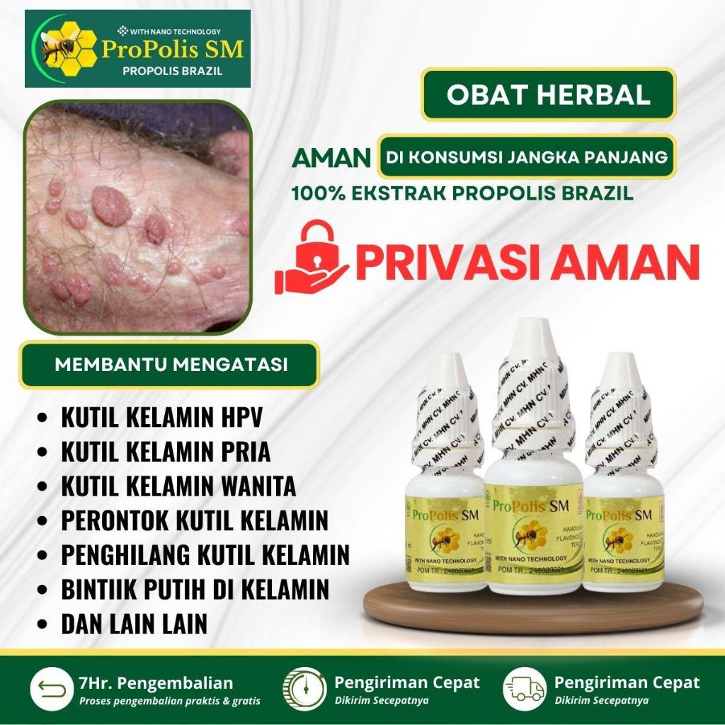 Obat Kutil Kelamin HPV, Kutil Anus, Perontok Kutil Kelamin, Kutil Kelamin Pria, Kutil Kelamin Wanita