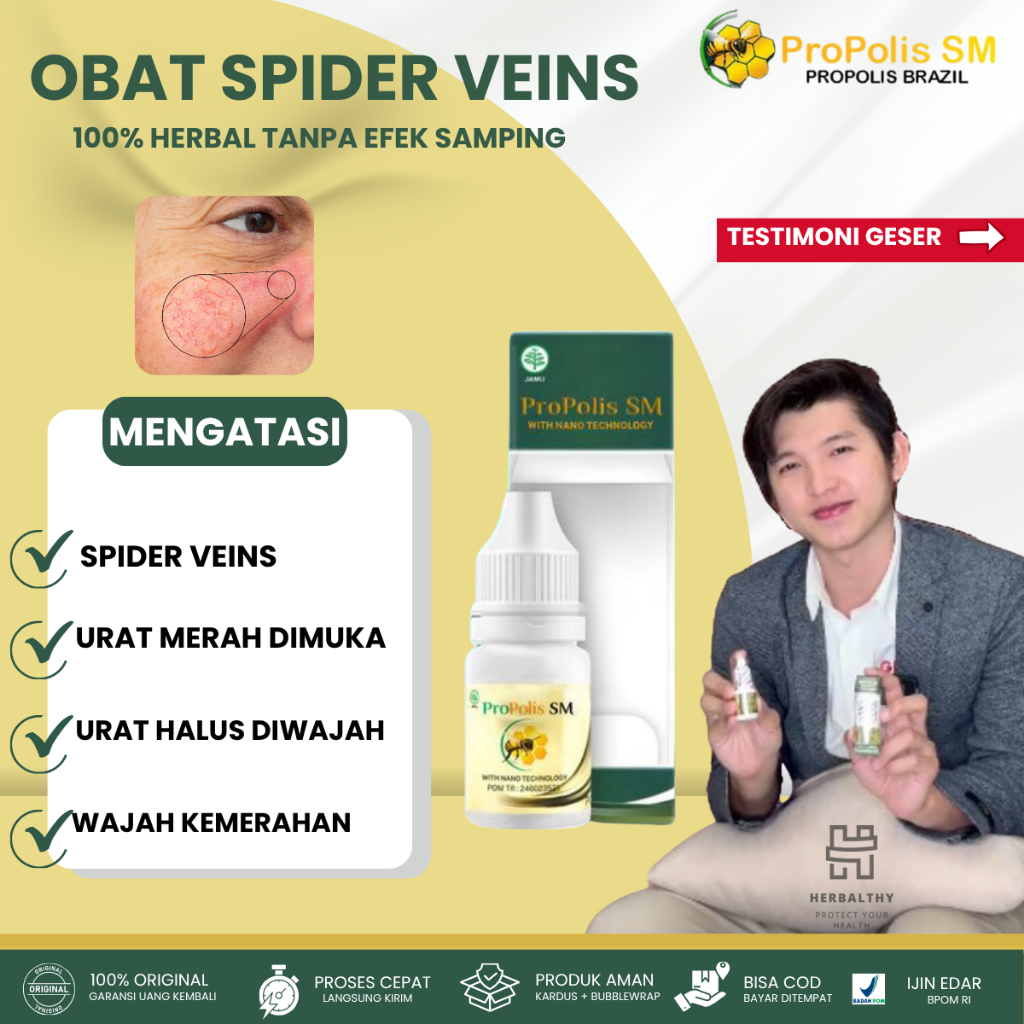 Obat Untuk Spider Vein, Obat Spider Vein ( Urat muka) Obat Urat Merah, Obat Penghilang Urat Halus Di
