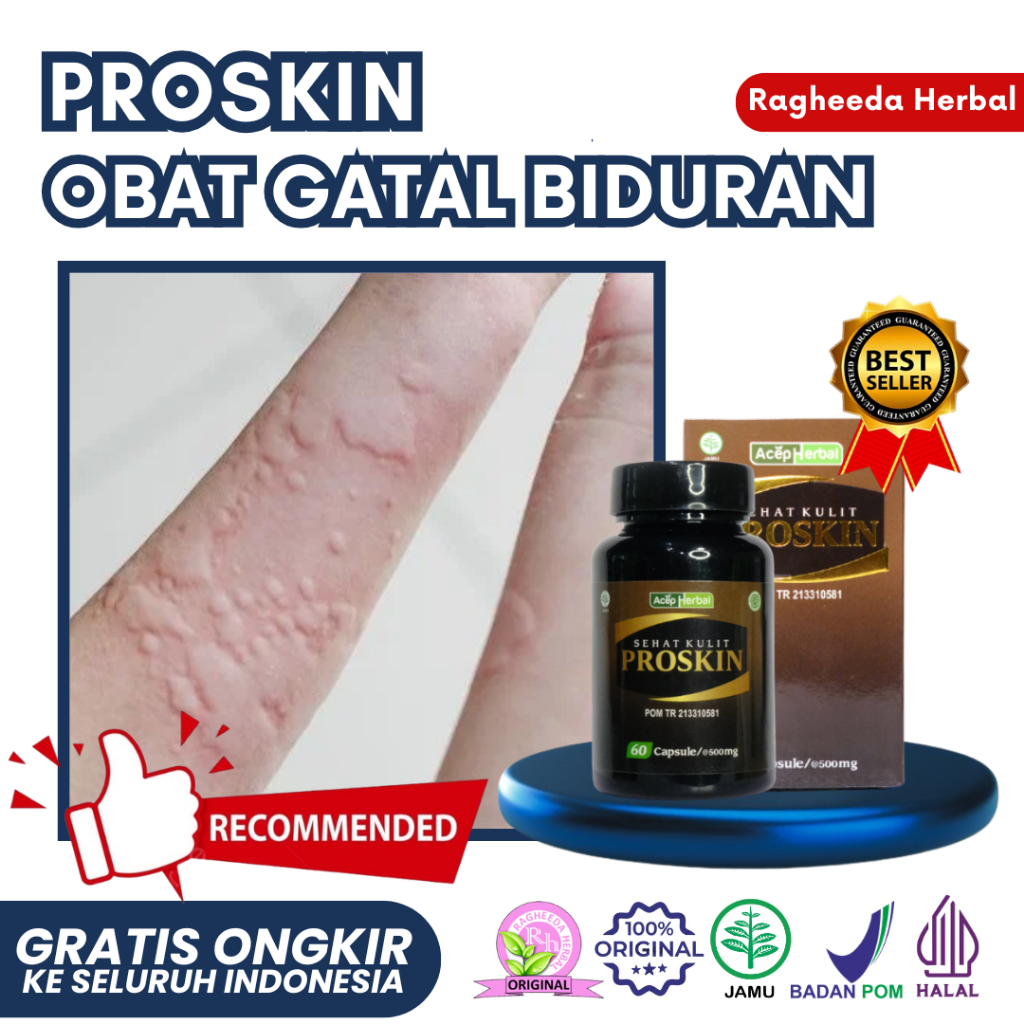 Obat Biduran Seluruh Badan, Urtikaria, Bentol Merah Atau Putih Sangat Gatal, Alergi Akibat Serangga,