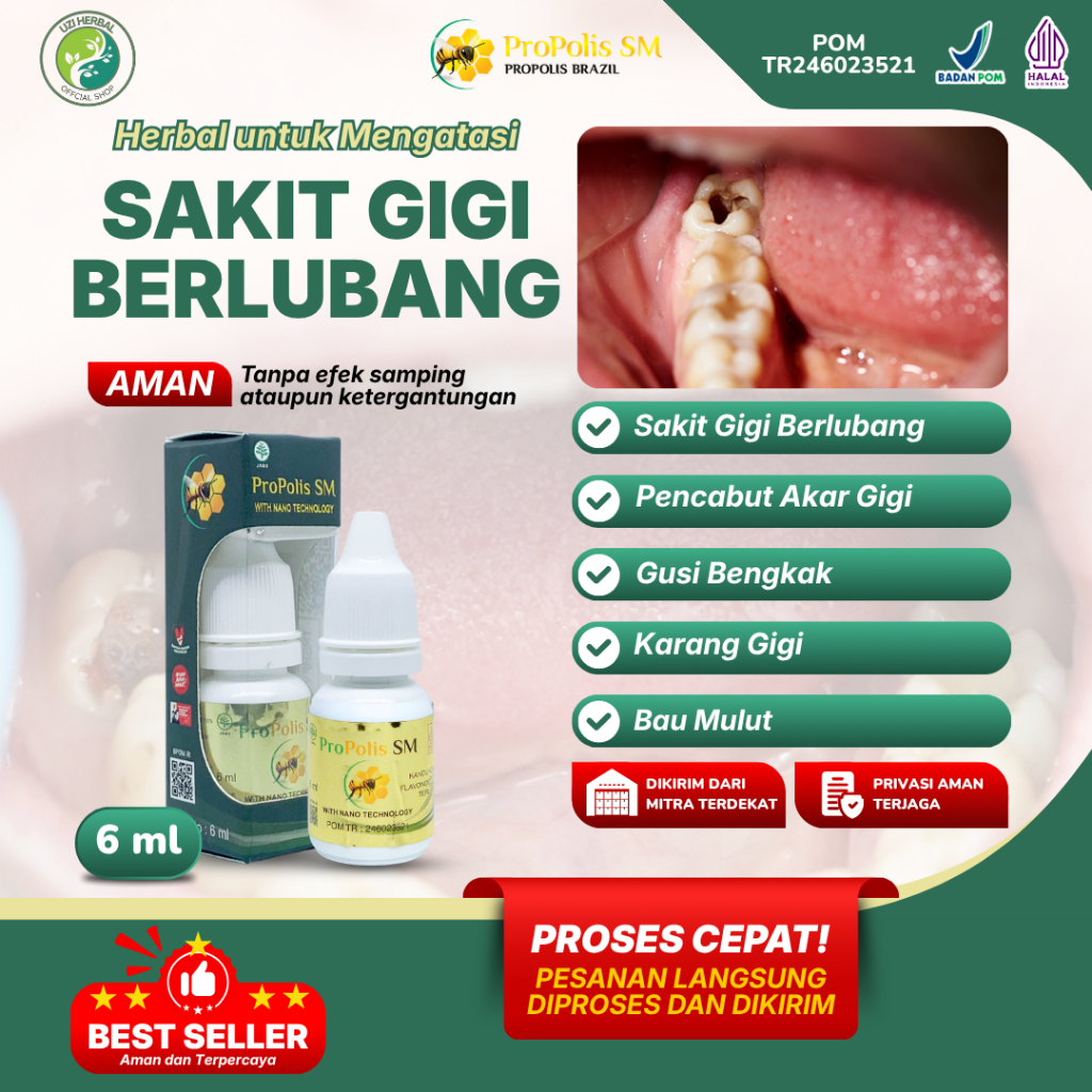Obat Sakit Gigi Berlubang, Pencabut Akar Gigi, Gusi Bengkak, Karang Gigi,  Obat Bau Mulut - Propolis