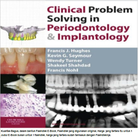 Clinical Problem Solving In Periodontology & Implantology