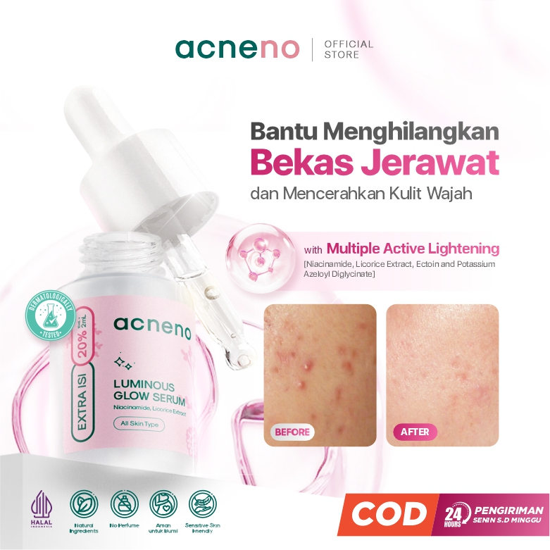 [PROMO TERBATAS] Serum Bekas Jerawat - Acneno Luminous Glow 12 ml | Serum Bantu Menghilangkan  Bekas