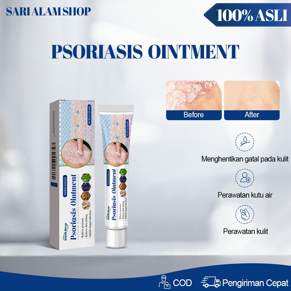 South Moon Psoriasis Ointment 20g Salep Anti Gatal Paling Ampuh  Meredakan Gatal Pada Psoriasis Alep