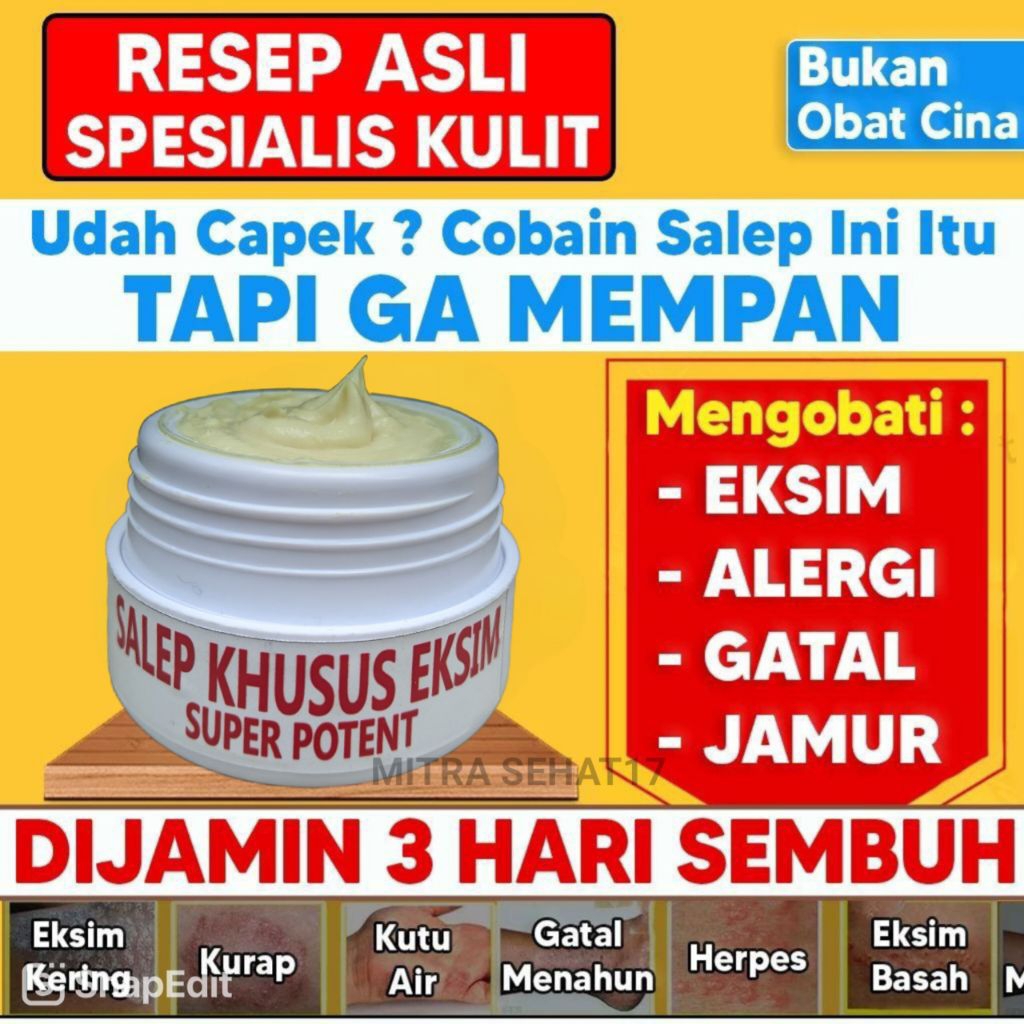 OBAT EKSIM BASAH,KERING,EKSIM MENAHUN,DERMATITIS JAMUR KULIT PALING AMPUH RACIKAN