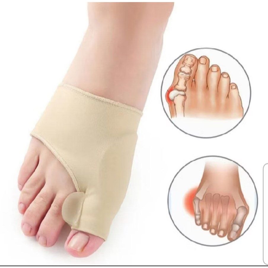 Bunion Hallux orthotics ns