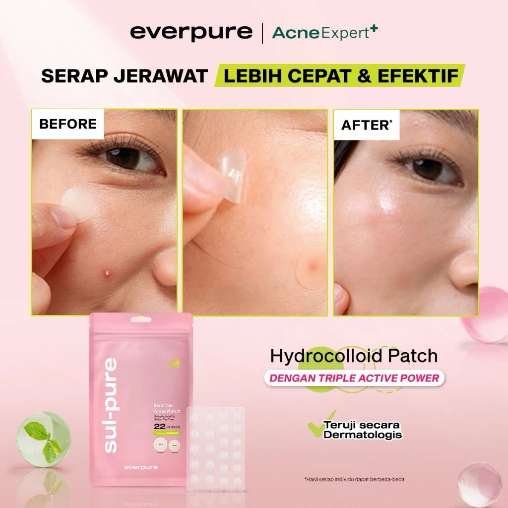 EVERPURE ACNE PATCH