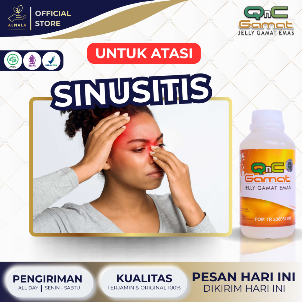 Obat Sinusitis, Infeksi Radang Sinusitis, Sinus Paranasal, Pilek Menahun, Polip Hidung, Hidung Bau B