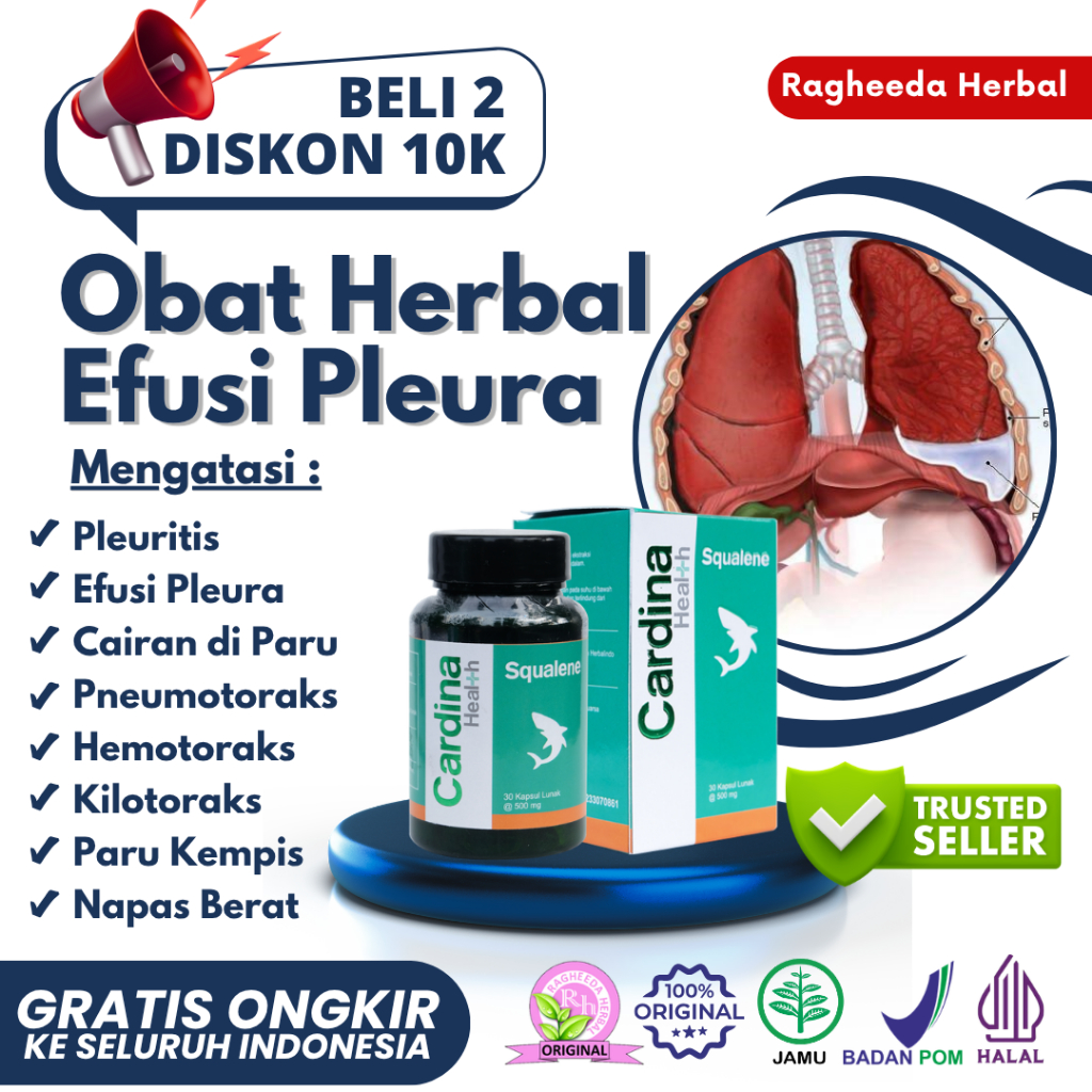 Obat Pleuritis, Efusi Pleura, Cairan di Paru, Nyeri Dada Saat Bernapas, Paru Basah, Obat Penumpukan 